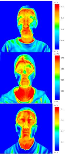 3) T J,mean : Mean skin temperature differences in Jadeite powder 3% containing O/W Wash-off Pack. 4) T N,mean : Mean skin temperature differences in Nephirte powder 3% containing O/W Wash-off Pack.