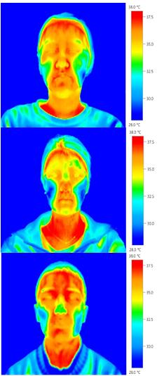 ± 0.2. (a) (b) Figure 8. Thermographs of the nephrite powder 3% containing O/W wash-off pack, (a) before treatment, (b) after treatment. Thermographs were taken at constant room temperature of 25 ± 0.