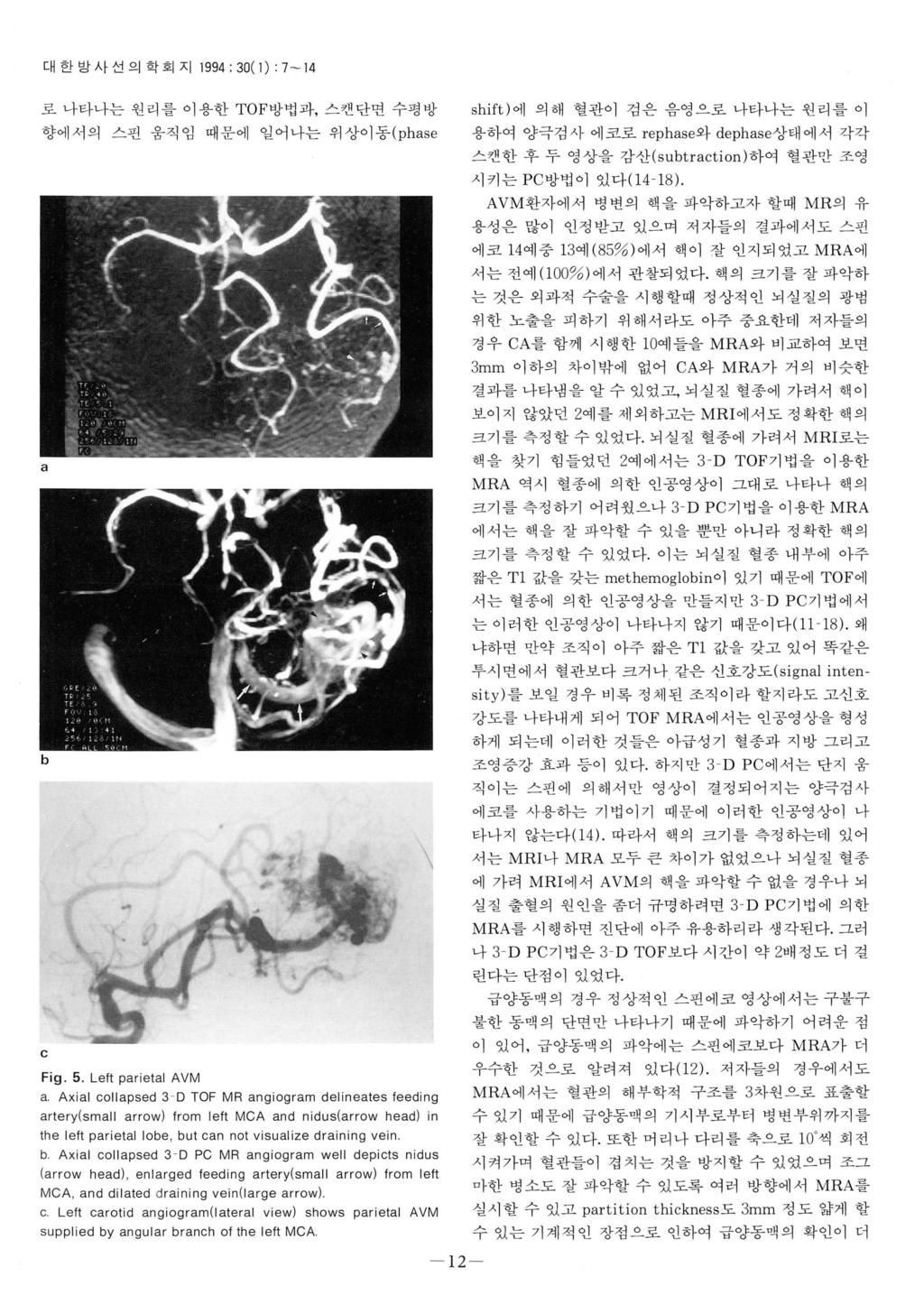 대한방사선의학회지 994 ; 3( ) 7-4 로나타나는원리를이용한 TO 방법과, 스캔단면수평방 향에서의스핀움직임때문에일어나는위상이동 (ph se shift) 에의해혈관이검은음영으로나타나는원리를이용하여양극검사에코로 rephse와 dephs e상태에서각각스캔한후두영상을감산 (sutrt ion) 하여혈관만조영시키는 PC 방법이있다 ( 4-8).