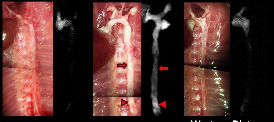 Molecular Imaging of Atherosclerosis Figure 2.