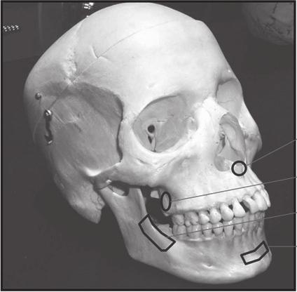 성공적인임플란트의조건과임플란트의합병증 8. 뼈이식을위한이식골은어떤종류가있나요? 자가골을사용하기도하고, 인공뼈로는사람뼈에서추출한동종골, 동물의뼈를사용한이종골과골조직성분으로구성된합성골이있다.