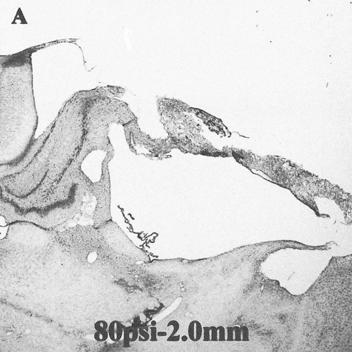 Animal Model of Controlled Cortical Injury 질부위가손상되었다. 그러나 3.9 m/s 의충격속도와 2. mm의변형깊이로뇌손상을가하였을때는뇌피질뿐아니라해마부위전체와치상회 (dentate gyrus) 의문 (hilus) 영역, 시상부위까지심하게손상됨을알수있었다 (Figure 2).