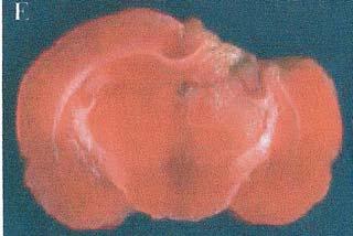 of tissue injury according to the various injury parameters (coronal section with 2 mm thickness).