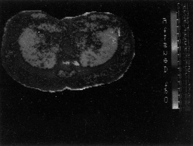 Total binding(left side) and nonspecific binding(right part) are shown. cold buffer로 5분간 씻은 후 0 의 증류수에 담근 후 실온에서 건조시켰다.