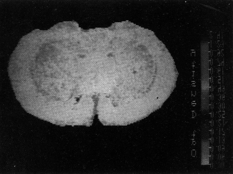 자가방사기록법 및 컴퓨터 영상분석 Fig. 7.