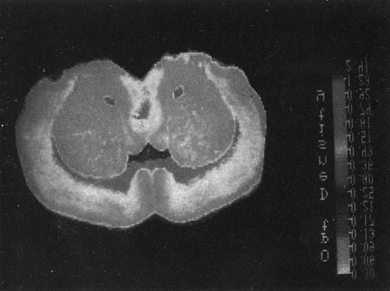 Fig. 8. Autoradiographic distribution of [ 3 H]spiperone binding in caudate-putamen and nucleus accumbens.