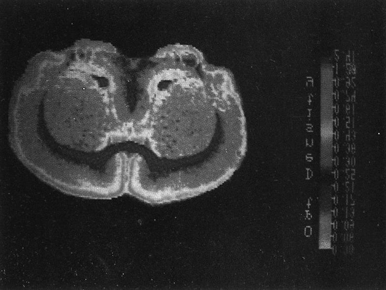 Total binding(left side) and nonspecific binding(right part) are shown. rapid fixer에 약 4분 간 고정한 후 깨끗이 씻고 건조 D2 수용체의 결합도를 보기 위해 미상핵-피각, 측좌 시킨다.