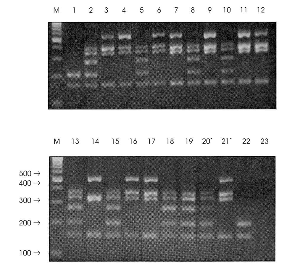 Fig. 1. The types of PCR patterns of MRSA * : one person has two different geno types(ia and Ⅱ) 른쪽, 왼쪽을구분하였으므로양쪽에서동시에분리된경우가 6명이있어서총 22균주의유전자형분석결과를확인할수있었다.