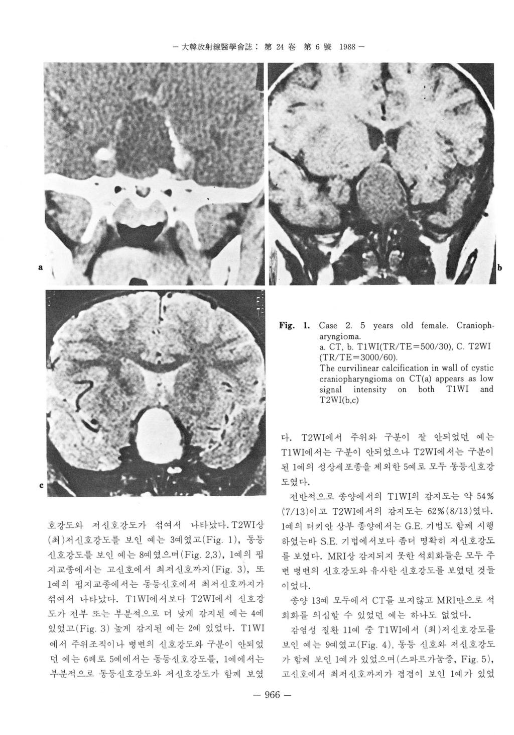 - 大韓放射線뿔學會註 : 第 24 卷第 6 號 1988 - Fig. 1. Case 2. 5 years old female. Craniopharyng loma a. CT, b. T1 WI(TR/ TE=500/ 30), C.