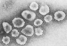 길라잡이 Coronavirus infections 원인 : single stranded RNA virus B814, 229E, OC43 역학 : limited studies common colds 의 10-20% rhinovirus 가주춤하는늦가을, 겨울, 이른봄매 2 년에 OC43, 2-4 년마다 229E 발생 임상증상 : 연구필요 Respiratory