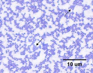 Application of staining to fixed tissue 직접염색 (direct staining) 매염제