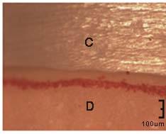 Cercon c. Ceramill d. Rainbow e. Zirkonzhan Fig. 1.