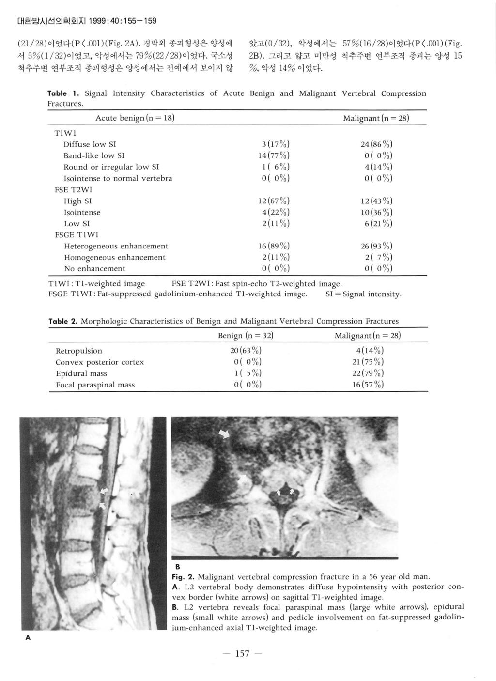 대한밤사선의학회 :;\1 1999 ; 40 : 155-159 ( 2 1/ 28) 이었다 ( P <.00l )(Fig. 2A). 경막외종괴형성은양성에 서 5% (1 /32 ) 이였고, 악성에서는 79 % ( 22/28 ) 이었다.