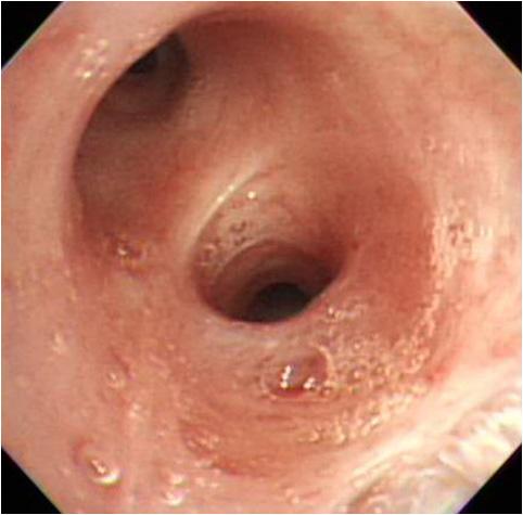 The Korean Journal of Medicine: Vol. 83, No. 5, 2013 A B Figure 5.