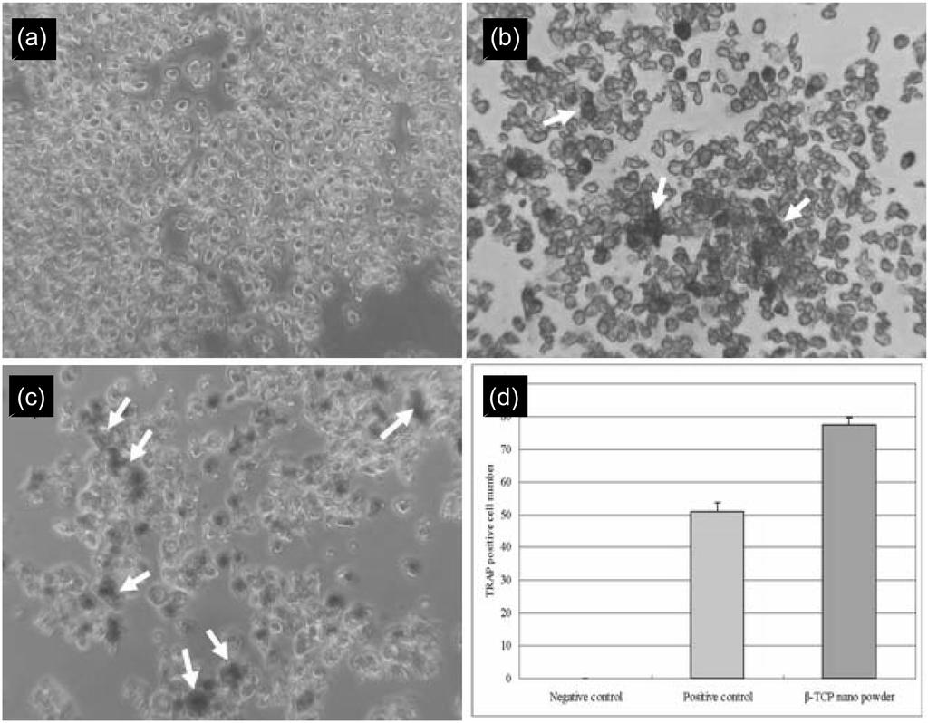 대식세포가 β-tricalcium Phosphate 뼈이식제의 생분해에 미치는 영향 Fig. 2. Fig. 3. 621 Inverted microscopic images of differentiated Raw 264.7 cells; (a) control Raw 264.