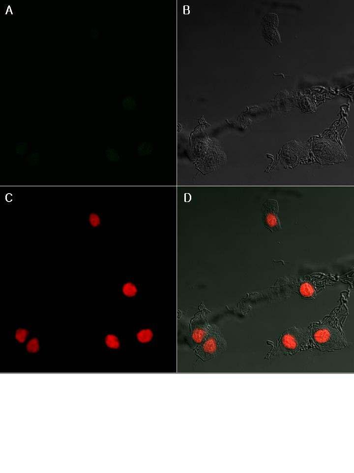Fig. 22. Morphological change of nuclear chromatin in HepG2 treated with S. sarmentosum extract was viewed under a fluorescence microscopy (X100) on 72 hrs.