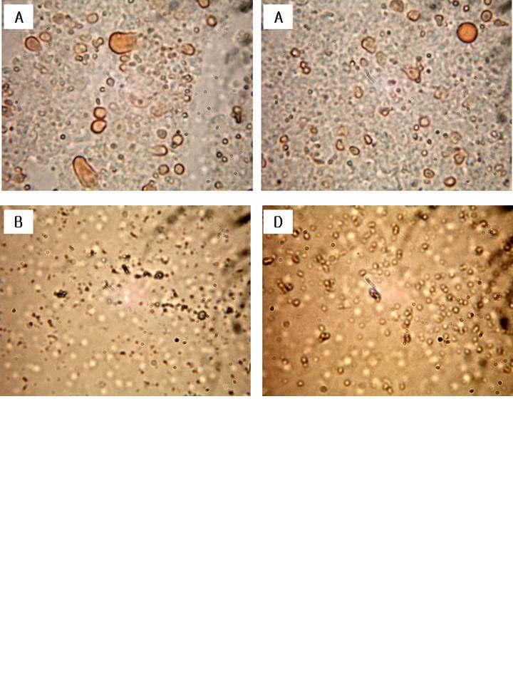 Fig. 64. Oil red O staining of adipocytes treated with S. sarmentosum extracts. A; control, B; ethyl acetate extract, D; butanol extract Table 13. Size of adipocytes treated with S.