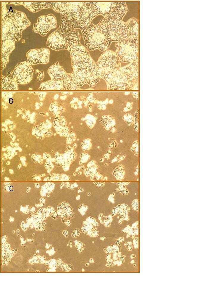 Fig. 5. Effects of butanol and ethyl acetate extracts of S. sarmentosum on HepG2 morphology.