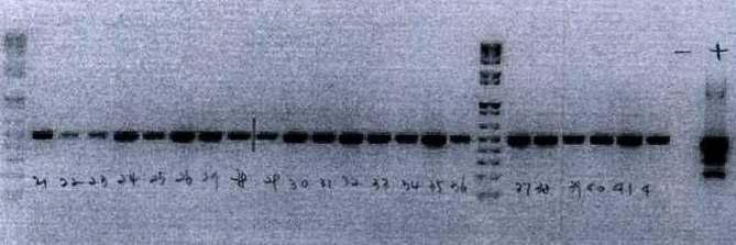 외부 유전자의 삽입이 homozygote한 식물체를 다 시 선발한 뒤 과실을 수확하여 후대에서 PCR을 통하여 외부 유전자의 삽입 여부를 확인 (Fig. 7) M 1 2 3 4 5 6 7 8 9 10 11 12 13 14 15 16 M 17 18 19 20 21 22 Nc Pc Figure 7. PCR amplification of C.