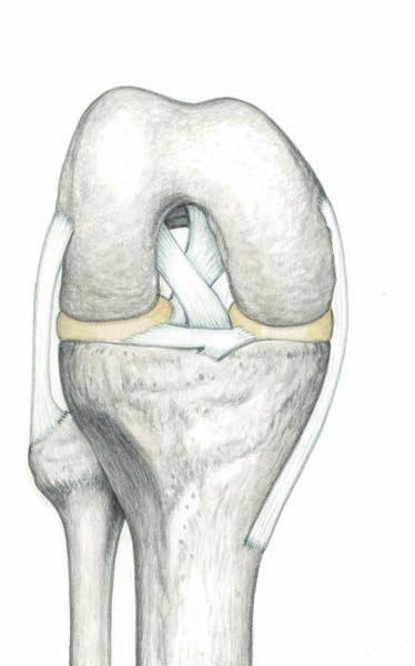 무릎관절의인대 반월판막 [ 앞면 : 굽힘자세 ] [ 뒷면 : 폄자세 ] 넙다리뼈가쪽관절융기 ( 대퇴골외측과 ) lateral femoral condyle 넙다리뼈가쪽위관절융기 ( 대퇴골외측상과 )