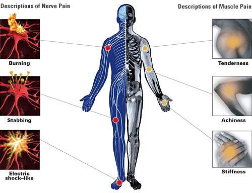 Types of pain ( 통증의종류 ) 시기에따른분류 급성통증 (Acute pain) 신체에서무엇인가문제가있거나손상을피하기위한반응. 조직손상에의해유발됨.