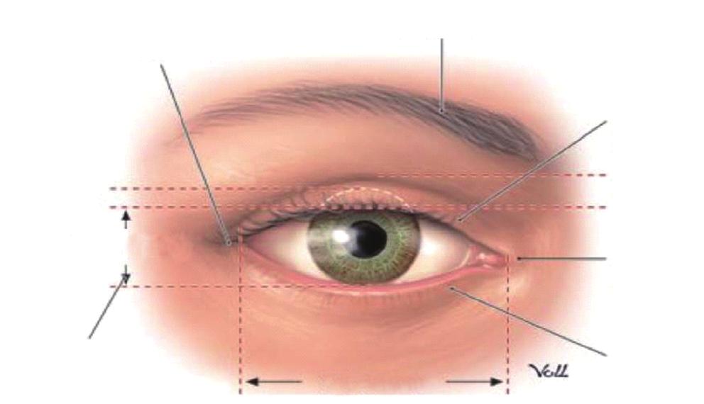 In Normal individuals, the upper lid covers the superior 1 to 2 mm of the eye iris, and the lower eye lid just reaches the inferior aspect of the iris (From THIEME Atlas of Anatomy, Head and