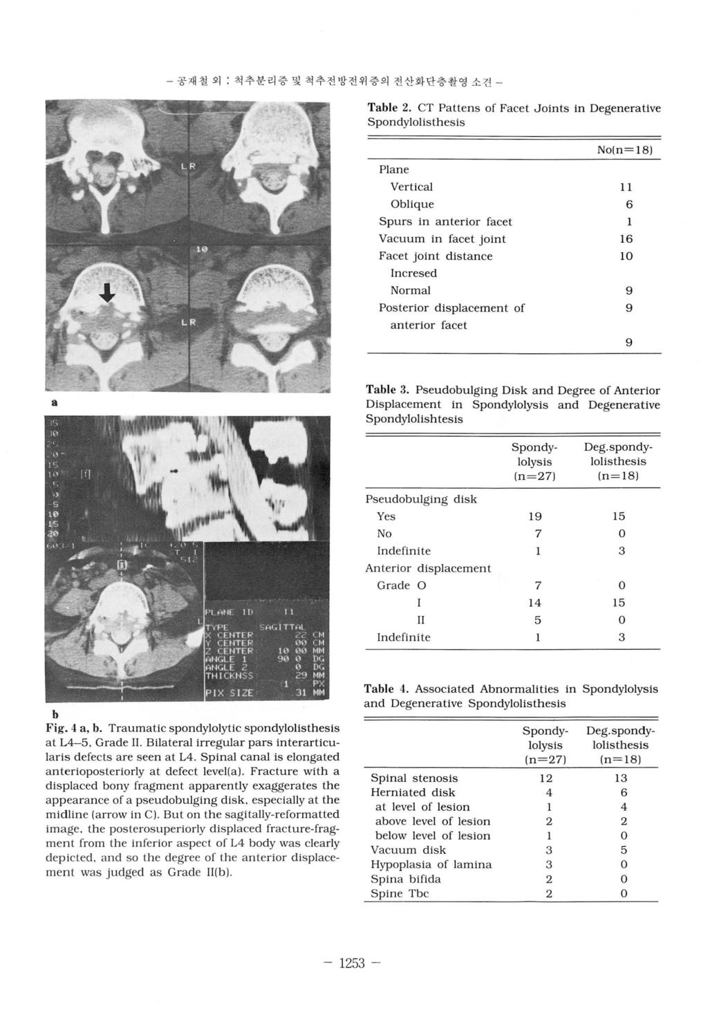 - 공재철외 : 척추분리증및척추전방전위증의전산화단충촬영소견 - Table 2.