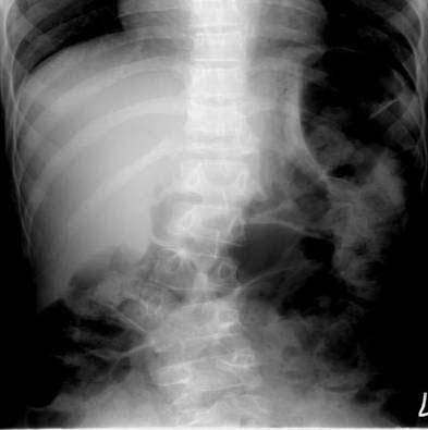 M / 14 Congenital