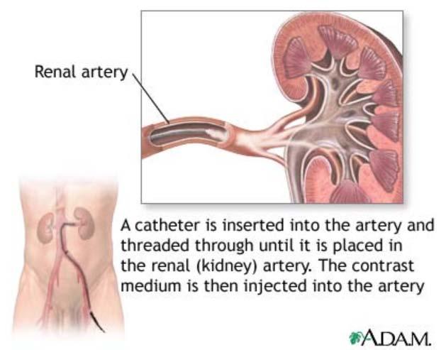 Renal