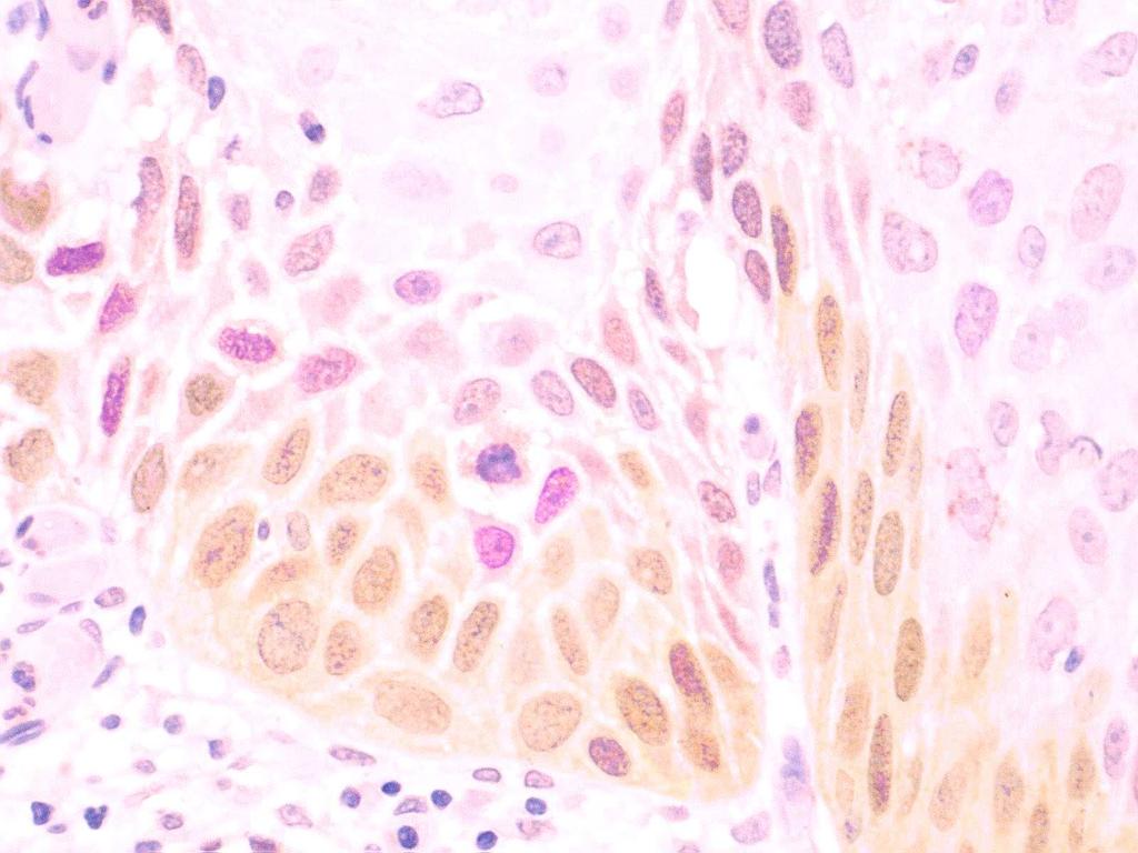 staining in normal cervical tissues. B.