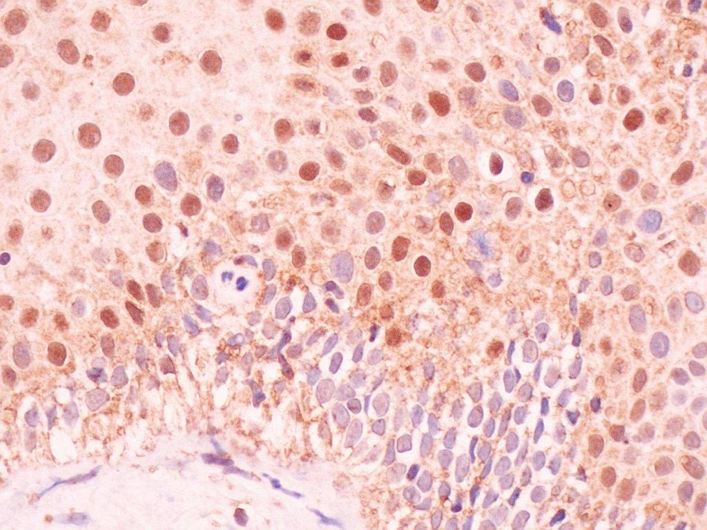 staining in normal cervical tissues.