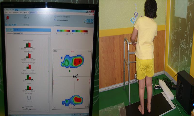 Hyun-Jin Choi and Ki-Won Nam : The Effect of Horseback Riding Simulator on Static Balance of Cerebral Palsy 3) 정적균형측정 (Pedoscan) 균형을측정하기위해 Pedoscan (Pedoscan, DIERS, 독일 ) 을사용하였다.