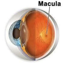 4) Diagnostic Terms (3) Diseases of inner coat( 내막성질환 )