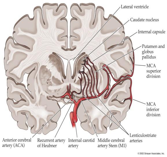 중뇌동맥폐색 -23- 출처 :https://classconnection.s3.amazon aws.com/237/flashcards/1210237/jpg/c erebral_arteries1329631279684.