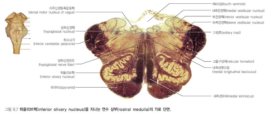 Rostral medulla( 연수상부 ) - open Cochlear nuclei( 달팽이핵 ) ventral cochlear nucleus & dorsal cochlear nucleus ICP 의배쪽면과등쪽면에위치