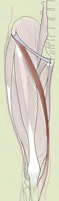 gracilis 큰모음근 ( 대내전근, adductor magnus 위앞엉덩뼈가시 ( 상전장골극, anterior superior iliac spine)
