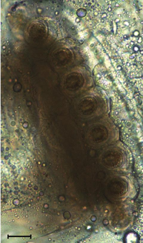 5 mm Fig. 2. Light microscopic and SEM views of the surface of a maggot.