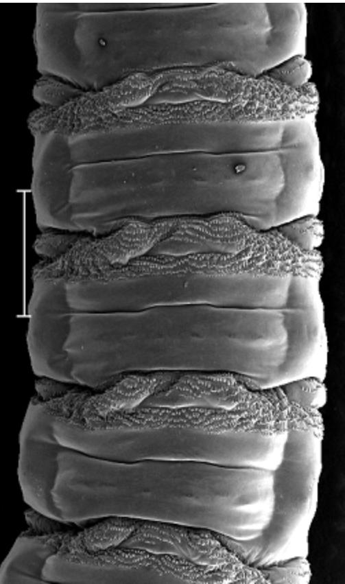 The spines were arranged in distinct bands around the body showing clearly defined spine bands (C, D).