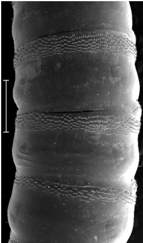 A light microscope image of the anterior spiracle showing a fan-like structure with 8 lobes (L).