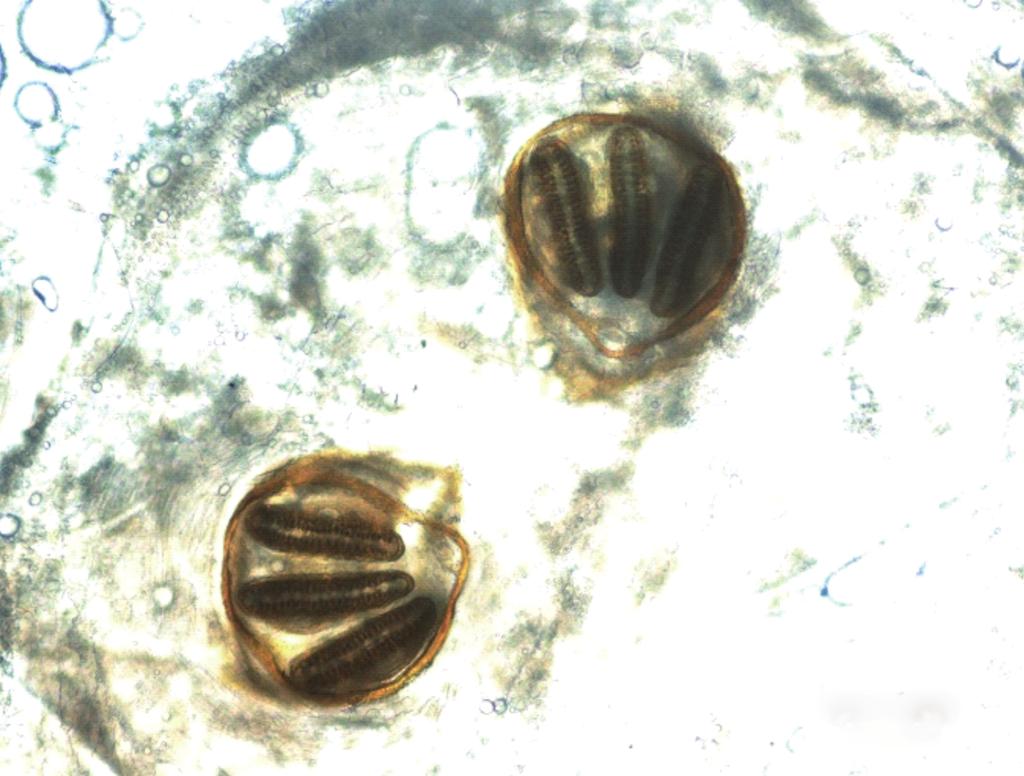 (B) The shape of the posterior spiracles was approximately round surrounded by a complete peritremal ring (pm) with no gap.