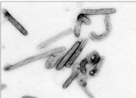 마버그바이러스시험백신, 원숭이연구를통해치료가능성증대 출처 : U.S. National Institute of Allergy and Infectious Diseases, 2010. 6.