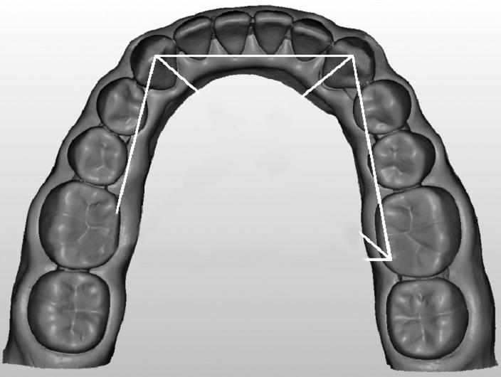 구동 테이블 위에 모형을 위치시킨 후 스캐닝 메뉴에서 전악(full arch)을 선택하여 동일한 조건하에 데이 터를 채득하였다(Fig. 3). 2. 선 계측 지점 14) 전악의 디지털 모형의 정확도를 평가하기 위해 Creed 등 의 연구에서 사용한 계측지점을 참고하여 총 4곳에 측정 지 점을 지정하였다.