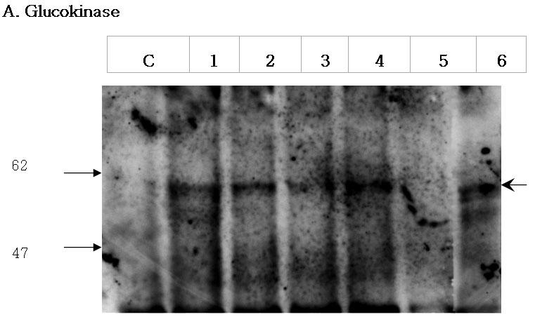 - 오승준외 4인 : 유전자조작근육모세포에서의포도당자극에의한인슐린분비 - Fig. 3. Western blot analysis of glucokinase or GLUT2 protein in C2C12-derived cell line at the 8 th week after transfection.