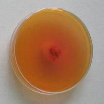 그림 11은배양 7일후오염된톱밥종균을 YPLP 고체진단배지에 48시간배양한후의발색반응및오염균의생장정도를나타낸것이다. 무접종대비춘추2호는색변화가없었고, 세균접종은적색으로, 푸른곰팡이접종은 T. atroviride는미황색으로그외접종구는적색으로변하였다. 처리내용무접종춘추 2 호 세균성갈반병 (Pseudomonas sp.) P. tolaasii P.