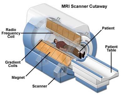 MRI http://video.about.