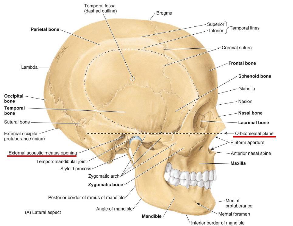 1.Skull( 머리뼈 ) 의구분 : nasion과 mastoid process의연장선을그어서구분 1)Neurocranium (cerebral cranium, cranial bone, 뇌머리뼈 ) -뇌를담고보호하는부분으로일명 brain case -뇌머리뼈의위는 calvaria( 머리덮개뼈 ) 이고, 아래는 cranial base( 머리뼈바닥 ) -6종류