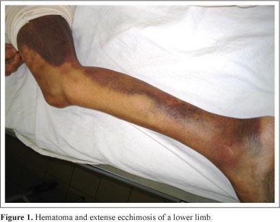 hemophilic arthritis( 혈우병성관절염 ) 혈우병이있는환자에서나타나는관절질환