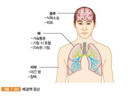 폐결핵 pulmonary tuberculosis 폐결핵환자로부터나온미세한침방울혹은비말핵 (droplet nuclei,