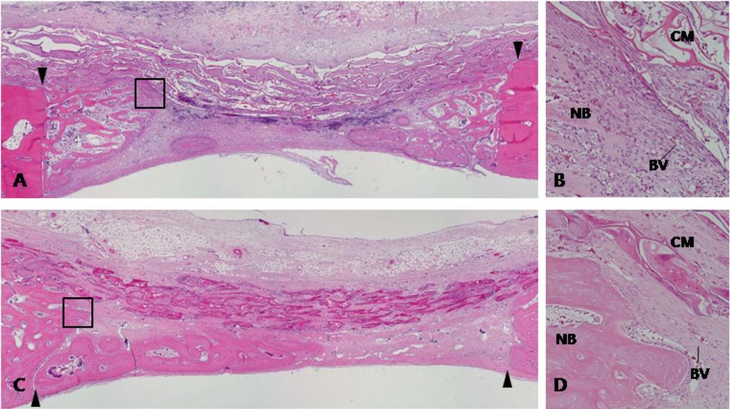 Guided Bone Regeneration using Cross-linked Type-I Collagen Membrane 125 Figure 4. Transversal histologic section of membrane group at 2 weeks (A, B) and 4 weeks (C, D).