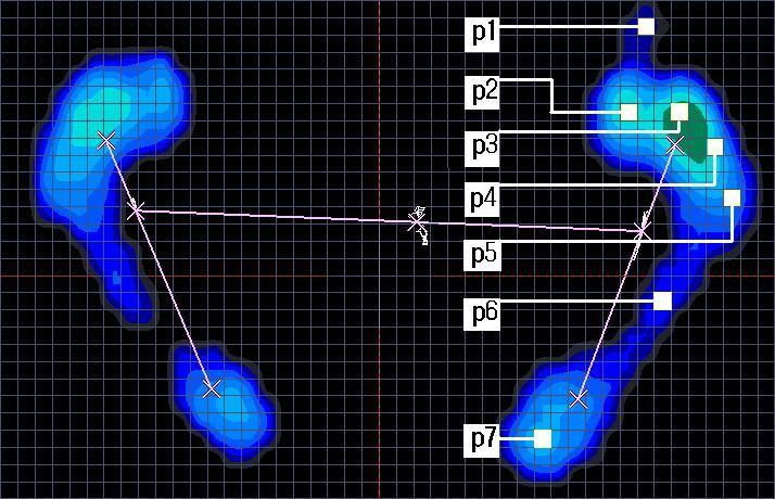 J Kor Soc Phys Ther 2010;22(2):1-6 추에반복적인비정상충격을전달하여척추질환의직접적인원인이되기도한다.